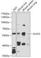 5'-Aminolevulinate Synthase 2 antibody, GTX65890, GeneTex, Western Blot image 