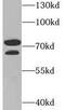 Peptidyl Arginine Deiminase 4 antibody, FNab06105, FineTest, Western Blot image 