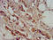 2-Aminoethanethiol Dioxygenase antibody, LS-C672489, Lifespan Biosciences, Immunohistochemistry paraffin image 
