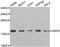 ADP Ribosylation Factor 6 antibody, TA327549, Origene, Western Blot image 