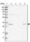 Leucine Rich Repeat Containing 75B antibody, NBP1-93522, Novus Biologicals, Western Blot image 