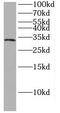 HAD antibody, FNab03743, FineTest, Western Blot image 