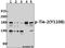 TEK Receptor Tyrosine Kinase antibody, A01274Y1108, Boster Biological Technology, Western Blot image 