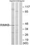 Ribosomal protein S6 modification-like protein B antibody, GTX87679, GeneTex, Western Blot image 