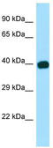 GULP PTB Domain Containing Engulfment Adaptor 1 antibody, TA338050, Origene, Western Blot image 