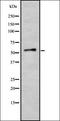 Fanconi anemia group A protein antibody, orb337534, Biorbyt, Western Blot image 