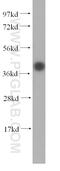 Replication Termination Factor 2 antibody, 16633-1-AP, Proteintech Group, Western Blot image 