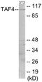 TATA-Box Binding Protein Associated Factor 4 antibody, EKC1617, Boster Biological Technology, Western Blot image 
