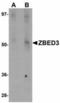 Zinc Finger BED-Type Containing 3 antibody, orb89829, Biorbyt, Western Blot image 