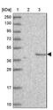 Chromosome 2 Open Reading Frame 69 antibody, PA5-60957, Invitrogen Antibodies, Western Blot image 