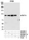 CTIP1 antibody, A700-073, Bethyl Labs, Immunoprecipitation image 