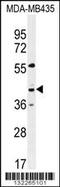 G Protein-Coupled Receptor 45 antibody, 56-301, ProSci, Western Blot image 