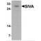 SIVA1 Apoptosis Inducing Factor antibody, MBS150365, MyBioSource, Western Blot image 