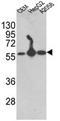 Prolyl 4-Hydroxylase Subunit Beta antibody, AP17615PU-N, Origene, Western Blot image 