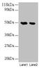 Neuroglobin antibody, LS-C211464, Lifespan Biosciences, Western Blot image 