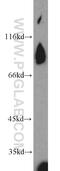 Meiotic recombination protein REC8 homolog antibody, 10793-1-AP, Proteintech Group, Western Blot image 