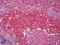 Plasma Cell Marker antibody, LS-B8622, Lifespan Biosciences, Immunohistochemistry frozen image 