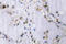 BMX Non-Receptor Tyrosine Kinase antibody, LS-C177060, Lifespan Biosciences, Immunohistochemistry paraffin image 