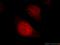 Squamous cell carcinoma antigen recognized by T cells 1 antibody, 22675-1-AP, Proteintech Group, Immunofluorescence image 