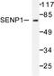 SUMO Specific Peptidase 1 antibody, AP06456PU-N, Origene, Western Blot image 