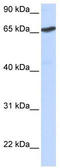 L3MBTL Histone Methyl-Lysine Binding Protein 1 antibody, TA339478, Origene, Western Blot image 