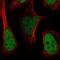 Histone Acetyltransferase 1 antibody, NBP1-87835, Novus Biologicals, Immunofluorescence image 