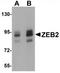 Zinc Finger E-Box Binding Homeobox 2 antibody, TA319793, Origene, Western Blot image 