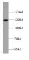 Angiomotin antibody, FNab00368, FineTest, Western Blot image 
