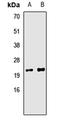 Translocase Of Inner Mitochondrial Membrane 10B antibody, orb412750, Biorbyt, Western Blot image 