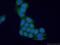 N-Acetylglucosamine Kinase antibody, 15051-1-AP, Proteintech Group, Immunofluorescence image 