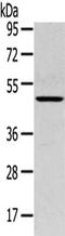 Serpin Family B Member 11 (Gene/Pseudogene) antibody, CSB-PA075099, Cusabio, Western Blot image 