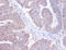 AP2S1 antibody, LS-C211718, Lifespan Biosciences, Immunohistochemistry paraffin image 