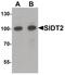 SID1 transmembrane family member 2 antibody, PA5-34493, Invitrogen Antibodies, Western Blot image 