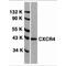 CD184 antibody, TA305936, Origene, Western Blot image 
