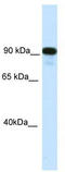 Class II Major Histocompatibility Complex Transactivator antibody, TA341750, Origene, Western Blot image 