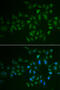 Myosin Light Chain Kinase 3 antibody, 22-389, ProSci, Immunofluorescence image 
