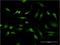 antibody, H00003397-M14, Novus Biologicals, Immunocytochemistry image 