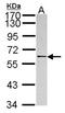 RNA Binding Motif Protein, Y-Linked, Family 1, Member A1 antibody, orb69781, Biorbyt, Western Blot image 