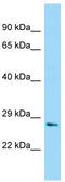 NUDT7 antibody, TA338314, Origene, Western Blot image 