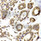 Ribosomal Protein L13 antibody, A6723, ABclonal Technology, Immunohistochemistry paraffin image 