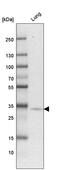 3-Hydroxyacyl-CoA Dehydratase 4 antibody, HPA058666, Atlas Antibodies, Western Blot image 