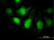 Protein Phosphatase 3 Regulatory Subunit B, Alpha antibody, LS-C197975, Lifespan Biosciences, Immunofluorescence image 