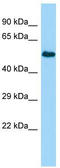 Tyrosyl-TRNA Synthetase 2 antibody, TA332234, Origene, Western Blot image 