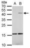 Interleukin 22 antibody, GTX127938, GeneTex, Western Blot image 
