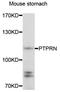 Protein Tyrosine Phosphatase Receptor Type N antibody, orb373384, Biorbyt, Western Blot image 