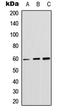 Akt antibody, LS-C358910, Lifespan Biosciences, Western Blot image 