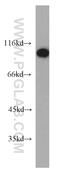 Cutaneous T-cell lymphoma-associated antigen 5 antibody, 55279-1-AP, Proteintech Group, Western Blot image 