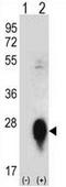 C-Type Lectin Domain Family 3 Member B antibody, AP50962PU-N, Origene, Western Blot image 