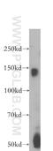 Bone Morphogenetic Protein Receptor Type 2 antibody, 19087-1-AP, Proteintech Group, Western Blot image 