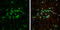 Growth Differentiation Factor 10 antibody, GTX118039, GeneTex, Immunocytochemistry image 
